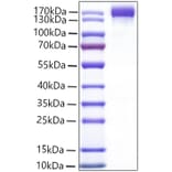 SDS-PAGE - Recombinant Mouse VEGF Receptor 2 Protein (C-terminal Human Fc Tag) (A331940) - Antibodies.com