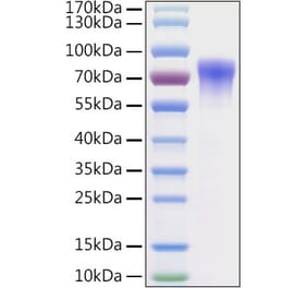 SDS-PAGE - Recombinant Mouse Vitronectin Protein (C-terminal His Tag) (A331941) - Antibodies.com