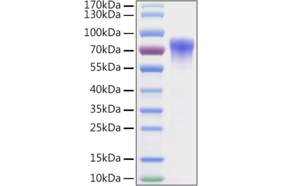 SDS-PAGE - Recombinant Mouse Vitronectin Protein (C-terminal His Tag) (A331941) - Antibodies.com