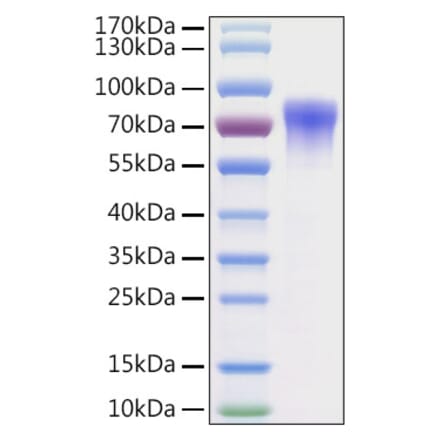 SDS-PAGE - Recombinant Mouse Vitronectin Protein (C-terminal His Tag) (A331941) - Antibodies.com