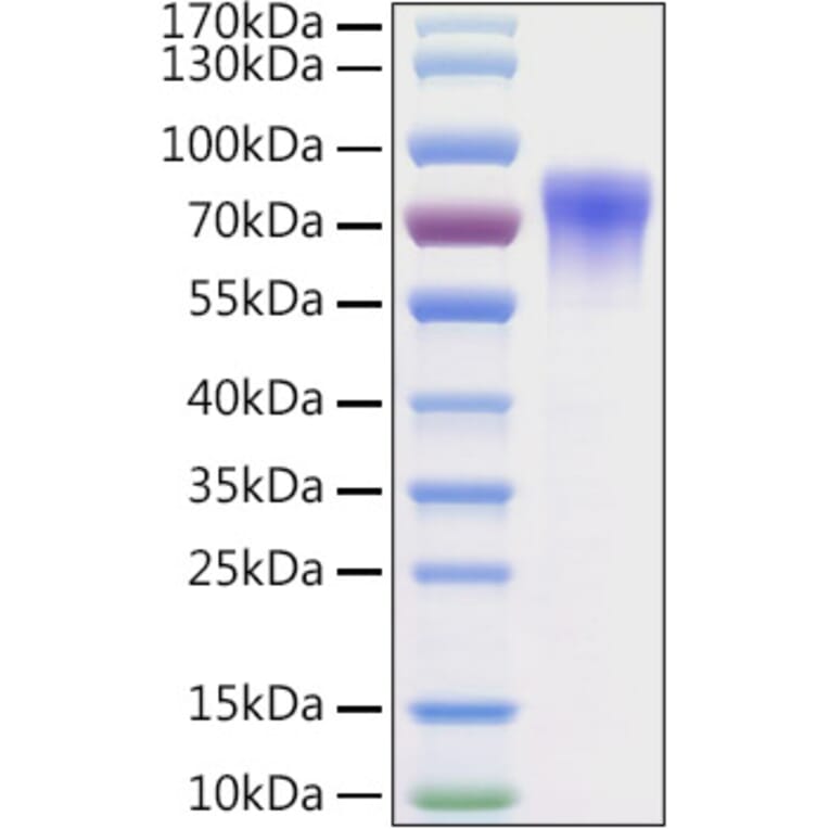 SDS-PAGE - Recombinant Mouse Vitronectin Protein (C-terminal His Tag) (A331941) - Antibodies.com