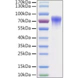 SDS-PAGE - Recombinant Mouse Vitronectin Protein (C-terminal His Tag) (A331941) - Antibodies.com