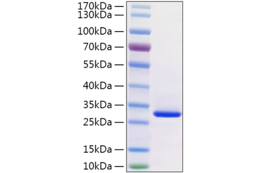 SDS-PAGE - Recombinant Human VSIG8 Protein (C-terminal His Tag) (A331942) - Antibodies.com