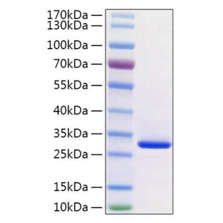 SDS-PAGE - Recombinant Human VSIG8 Protein (C-terminal His Tag) (A331942) - Antibodies.com