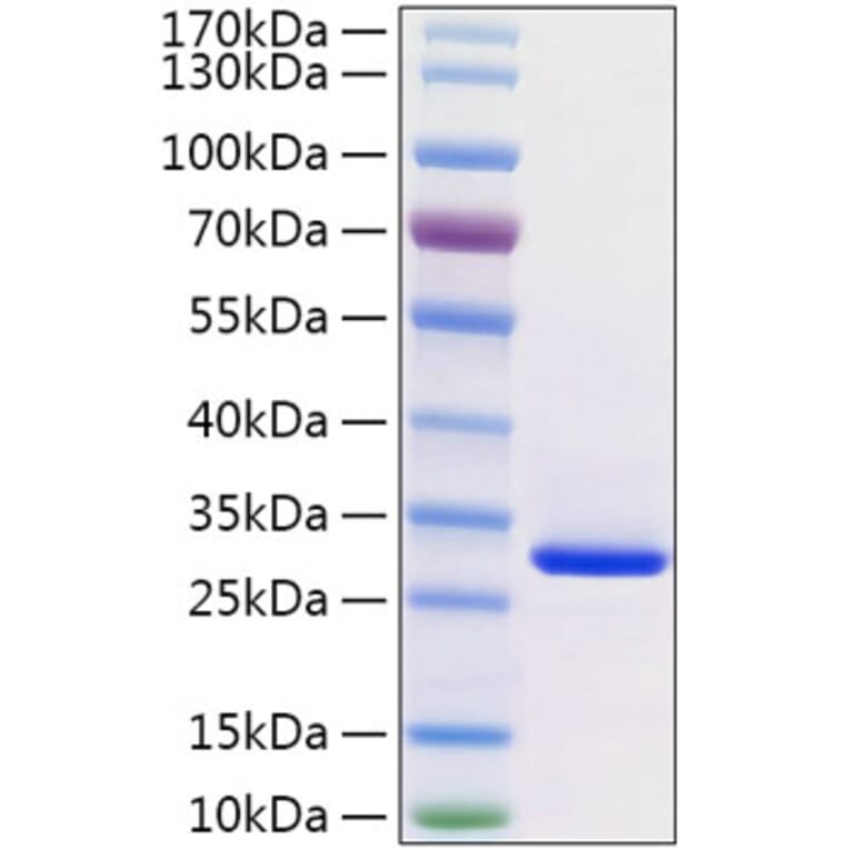 SDS-PAGE - Recombinant Human VSIG8 Protein (C-terminal His Tag) (A331942) - Antibodies.com