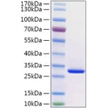 SDS-PAGE - Recombinant Human VSIG8 Protein (C-terminal His Tag) (A331942) - Antibodies.com