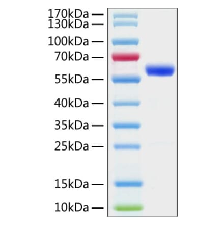 SDS-PAGE - Recombinant SARS-CoV-2 Spike RBD Protein (C-terminal Mouse Fc Tag) (A331944) - Antibodies.com
