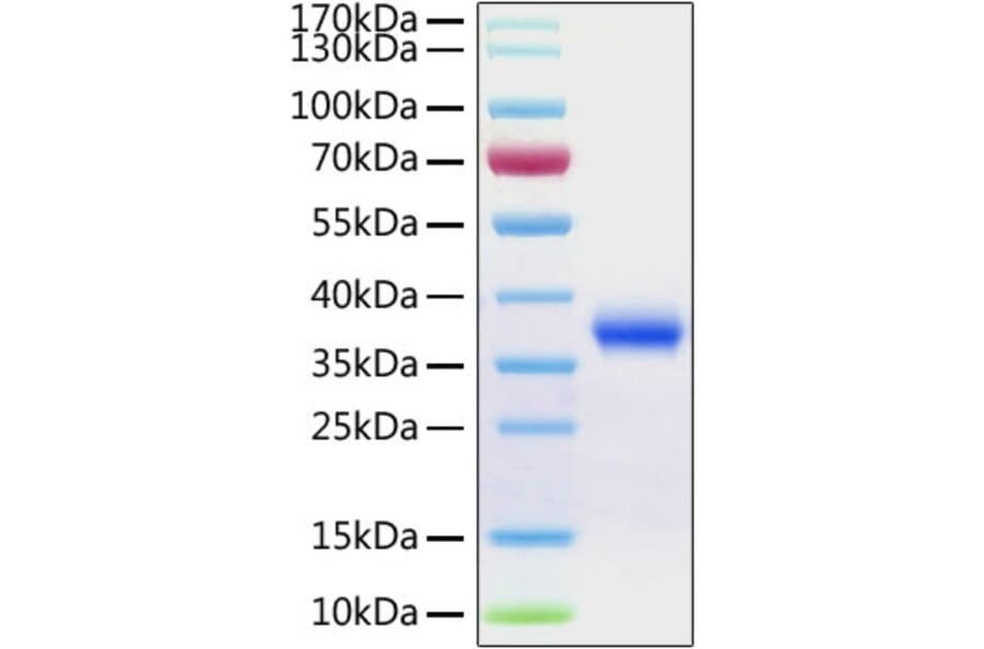 SDS-PAGE - Recombinant SARS-CoV-2 Spike RBD Protein (C-terminal His Tag) (A331945) - Antibodies.com