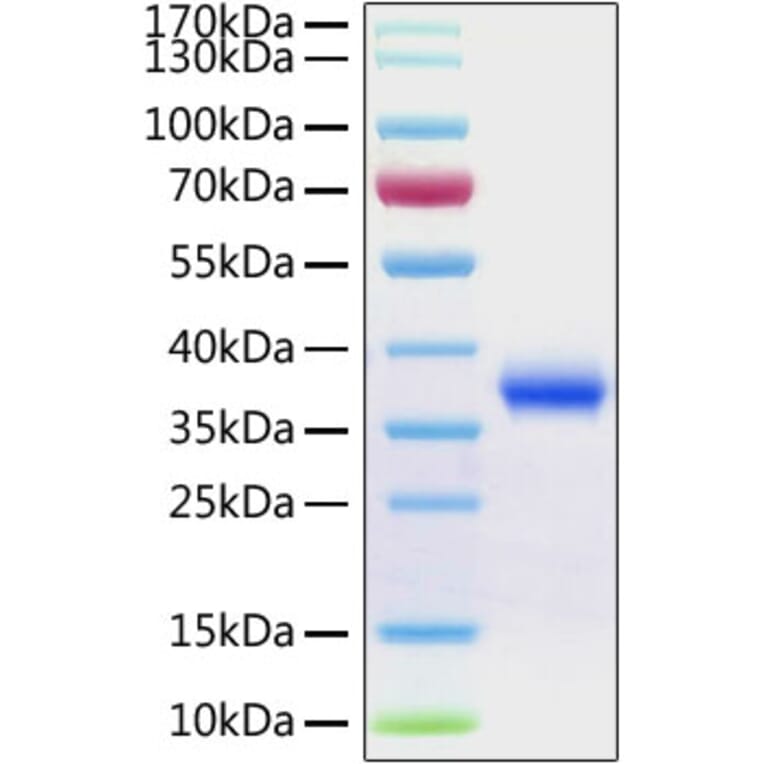 SDS-PAGE - Recombinant SARS-CoV-2 Spike RBD Protein (C-terminal His Tag) (A331945) - Antibodies.com