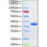 SDS-PAGE - Recombinant SARS-CoV-2 Spike RBD Protein (C-terminal His Tag) (A331945) - Antibodies.com