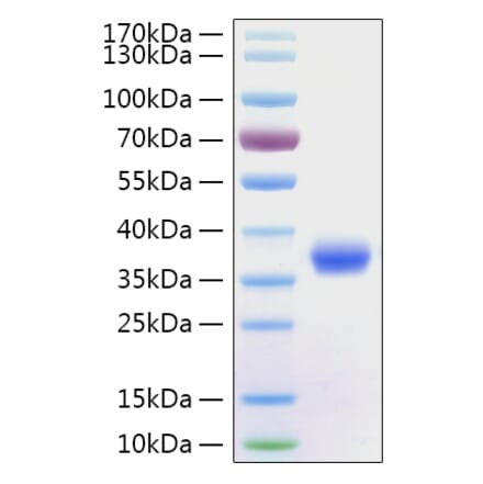 SDS-PAGE - Recombinant SARS-CoV-2 Spike RBD Protein (C-terminal His Tag) (A331946) - Antibodies.com