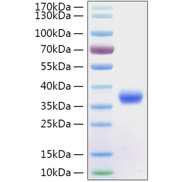 SDS-PAGE - Recombinant SARS-CoV-2 Spike RBD Protein (C-terminal His Tag) (A331946) - Antibodies.com