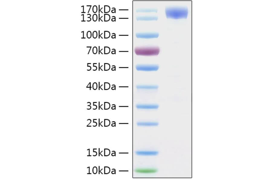SDS-PAGE - Recombinant SARS-CoV-2 Spike S1 Protein (C-terminal Human Fc and His Tag) (A331947) - Antibodies.com
