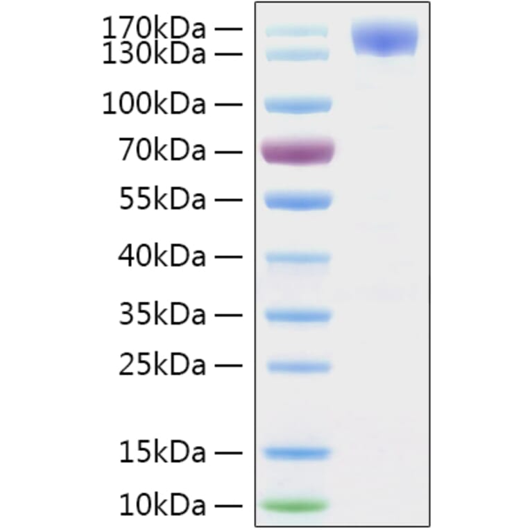 SDS-PAGE - Recombinant SARS-CoV-2 Spike S1 Protein (C-terminal Human Fc and His Tag) (A331947) - Antibodies.com
