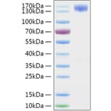SDS-PAGE - Recombinant SARS-CoV-2 Spike S1 Protein (C-terminal Human Fc and His Tag) (A331947) - Antibodies.com
