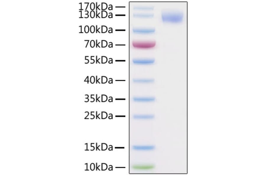 SDS-PAGE - Recombinant SARS-CoV-2 Spike S1 Protein (C-terminal His and Avi Tag) (A331948) - Antibodies.com