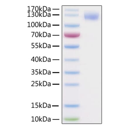 SDS-PAGE - Recombinant SARS-CoV-2 Spike S1 Protein (C-terminal His and Avi Tag) (A331948) - Antibodies.com