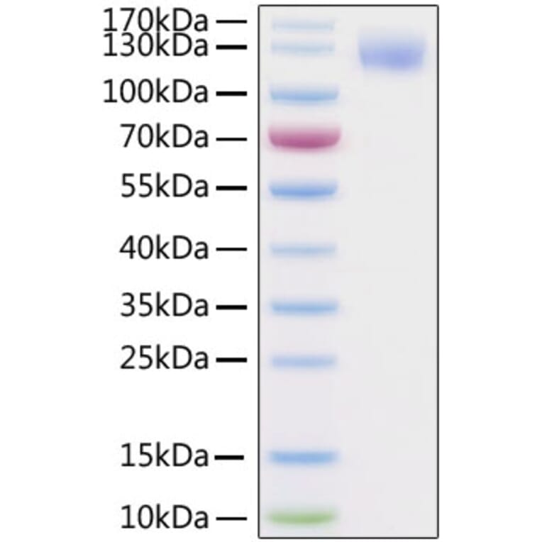 SDS-PAGE - Recombinant SARS-CoV-2 Spike S1 Protein (C-terminal His and Avi Tag) (A331948) - Antibodies.com