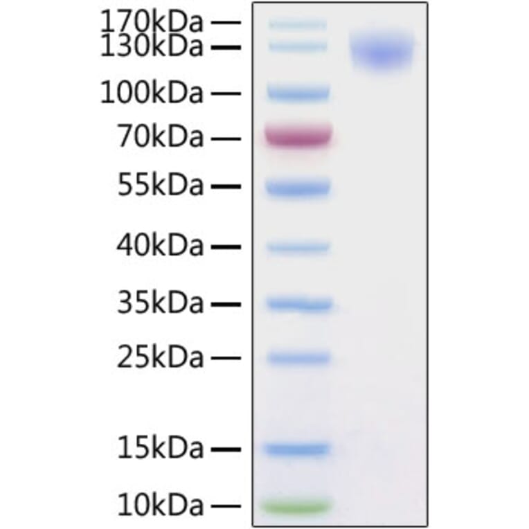 SDS-PAGE - Recombinant SARS-CoV-2 Spike S1 Protein (C-terminal His Tag) (A331949) - Antibodies.com