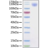 SDS-PAGE - Recombinant SARS-CoV-2 Spike S1 Protein (C-terminal His Tag) (A331949) - Antibodies.com