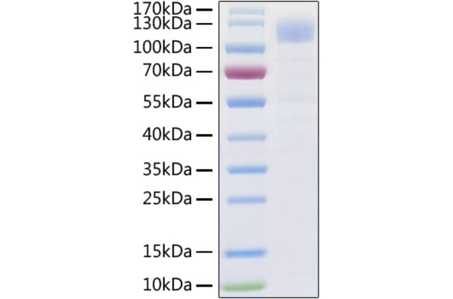 SDS-PAGE - Recombinant SARS-CoV-2 Spike S1 Protein (C-terminal His Tag) (A331950) - Antibodies.com