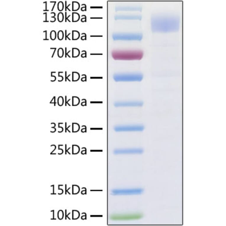 SDS-PAGE - Recombinant SARS-CoV-2 Spike S1 Protein (C-terminal His Tag) (A331950) - Antibodies.com