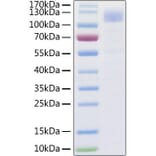 SDS-PAGE - Recombinant SARS-CoV-2 Spike S1 Protein (C-terminal His Tag) (A331950) - Antibodies.com