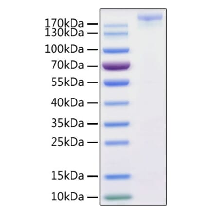 SDS-PAGE - Recombinant SARS-CoV-2 Spike S1+S2 ECD Protein (C-terminal His and Avi Tag) (A331951) - Antibodies.com