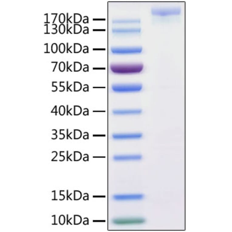 SDS-PAGE - Recombinant SARS-CoV-2 Spike S1+S2 ECD Protein (C-terminal His and Avi Tag) (A331951) - Antibodies.com