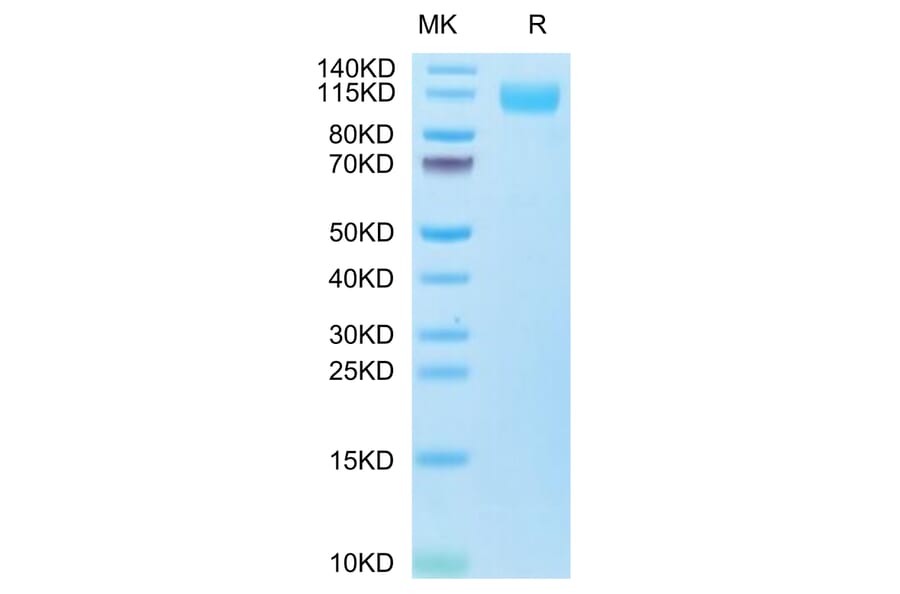SDS-PAGE - Recombinant SARS-CoV-2 Spike S1 Protein (C-terminal His and Avi Tag) (A331952) - Antibodies.com