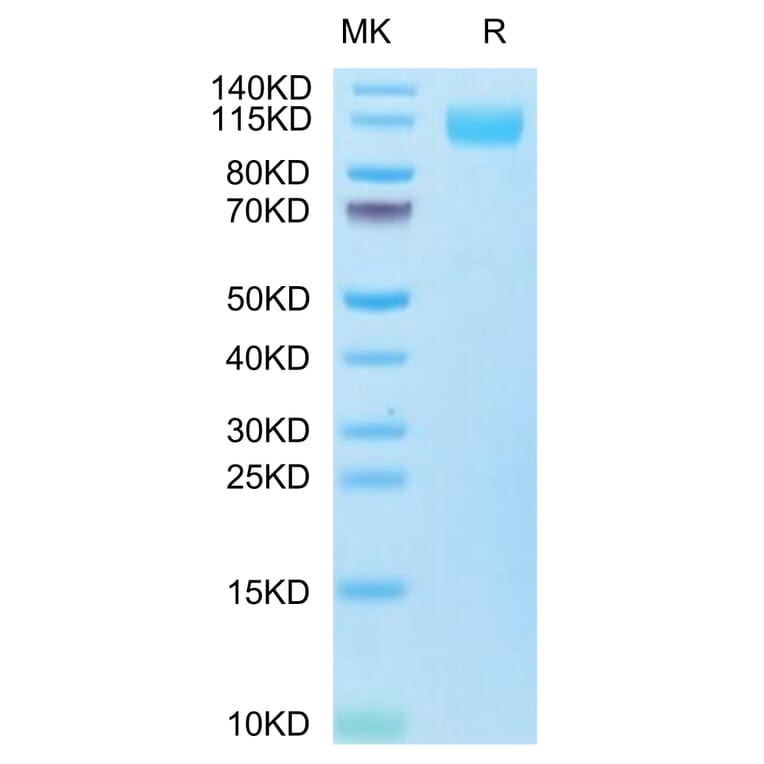 SDS-PAGE - Recombinant SARS-CoV-2 Spike S1 Protein (C-terminal His and Avi Tag) (A331952) - Antibodies.com