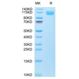 SDS-PAGE - Recombinant SARS-CoV-2 Spike S1 Protein (C-terminal His and Avi Tag) (A331952) - Antibodies.com