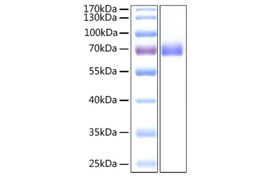 SDS-PAGE - Recombinant SARS-CoV-2 Spike S2 ECD Protein (C-terminal His Tag) (A331955) - Antibodies.com