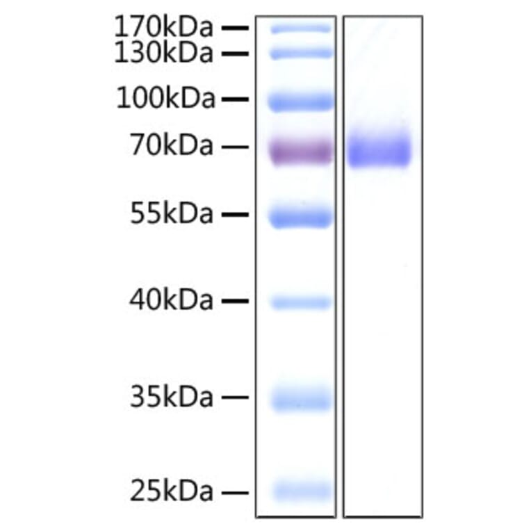 SDS-PAGE - Recombinant SARS-CoV-2 Spike S2 ECD Protein (C-terminal His Tag) (A331955) - Antibodies.com