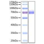 SDS-PAGE - Recombinant SARS-CoV-2 Spike S2 ECD Protein (C-terminal His Tag) (A331955) - Antibodies.com