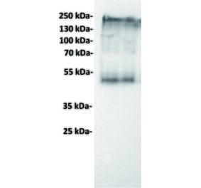 WB - Anti-CEA Antibody [1B5] (A332215) - Antibodies.com