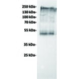 WB - Anti-CEA Antibody [1B5] (A332215) - Antibodies.com