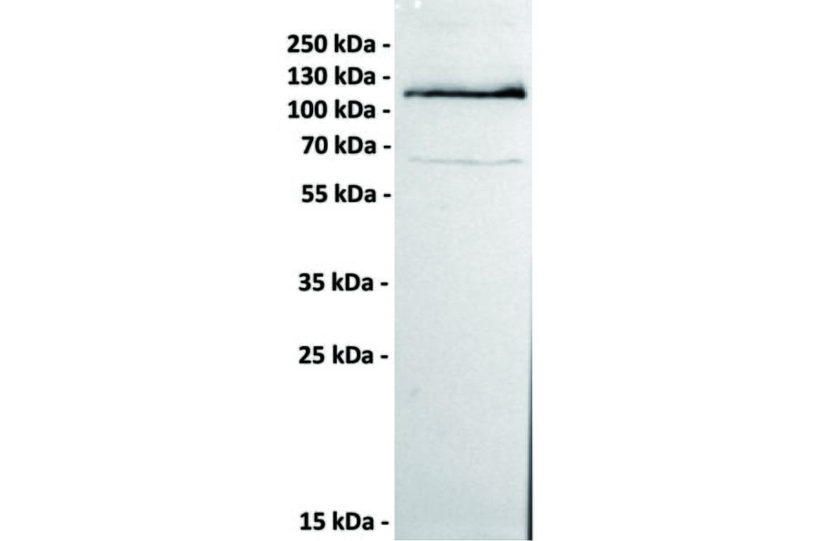 WB - Anti-ROR1 Antibody [151A5] (A332226) - Antibodies.com