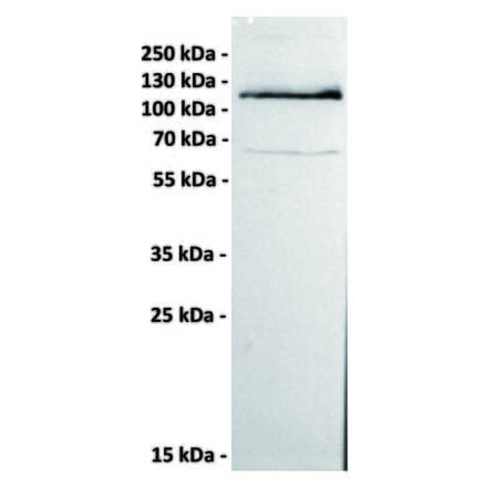 WB - Anti-ROR1 Antibody [151A5] (A332226) - Antibodies.com