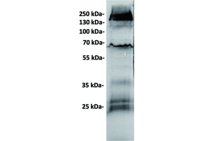 WB - Anti-GC-C Antibody [6E3] (A332330) - Antibodies.com