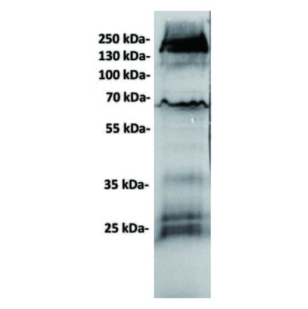 WB - Anti-GC-C Antibody [6E3] (A332330) - Antibodies.com