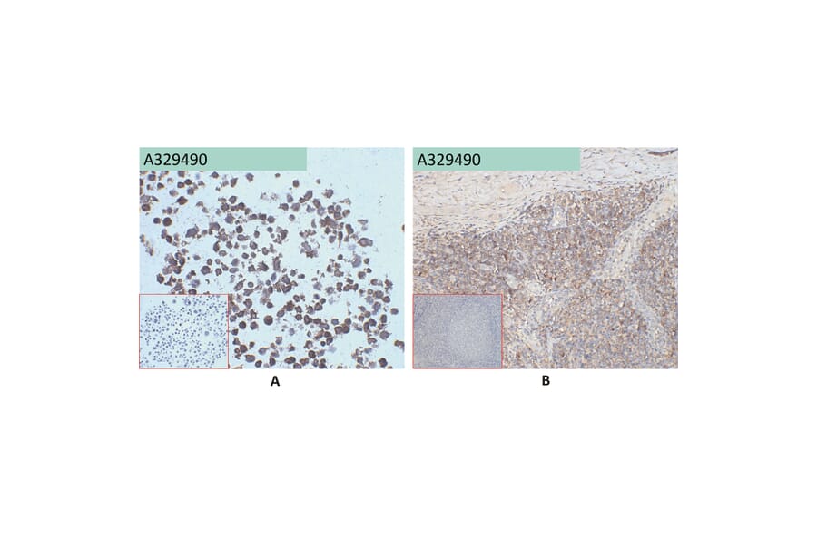 Immunohistochemistry - Anti-CD45 Antibody [7E1] (A332352) - Antibodies.com
