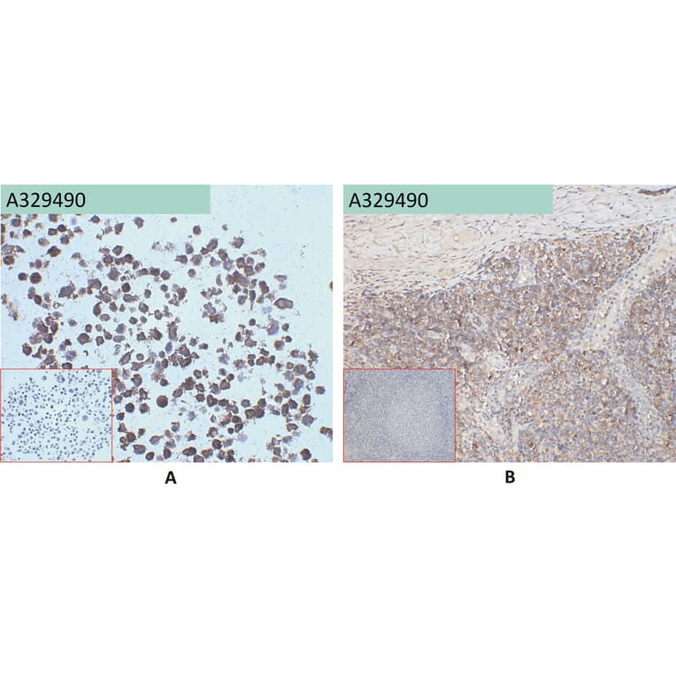 Immunohistochemistry - Anti-CD45 Antibody [7E1] (A332352) - Antibodies.com