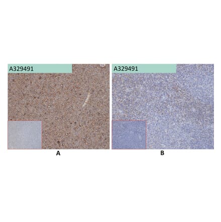 Immunohistochemistry - Anti-SELPLG Antibody [68H10] (A332353) - Antibodies.com
