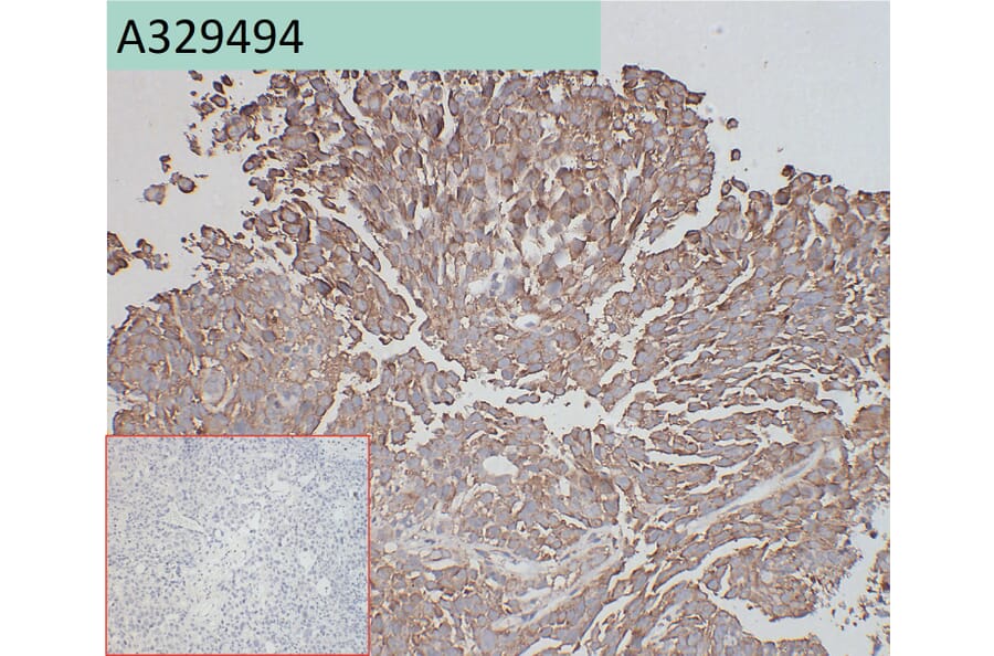 Immunohistochemistry - Anti-ADAM9 Antibody [45G10] (A332356) - Antibodies.com