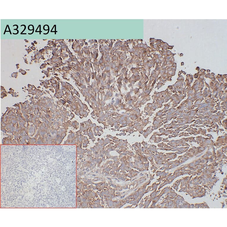 Immunohistochemistry - Anti-ADAM9 Antibody [45G10] (A332356) - Antibodies.com