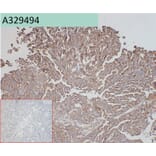 Immunohistochemistry - Anti-ADAM9 Antibody [45G10] (A332356) - Antibodies.com