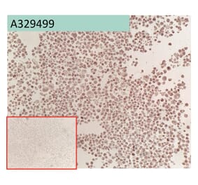 Immunohistochemistry - Anti-Glypican 3 Antibody [163D11] (A332361) - Antibodies.com