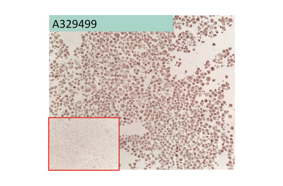 Immunohistochemistry - Anti-Glypican 3 Antibody [163D11] (A332361) - Antibodies.com