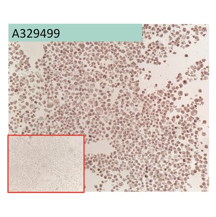 Immunohistochemistry - Anti-Glypican 3 Antibody [163D11] (A332361) - Antibodies.com
